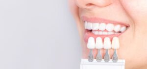 Read more about the article Veneers: A Smile Makeover’s Pros and Cons